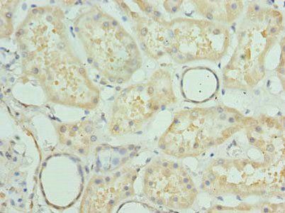 PRMT6 Antibody
