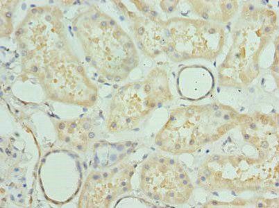 PRMT6 antibody