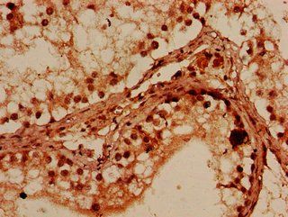 PRMT7 antibody