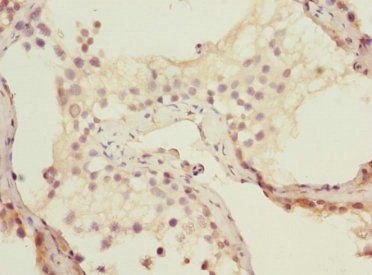 SMARCA2 Antibody