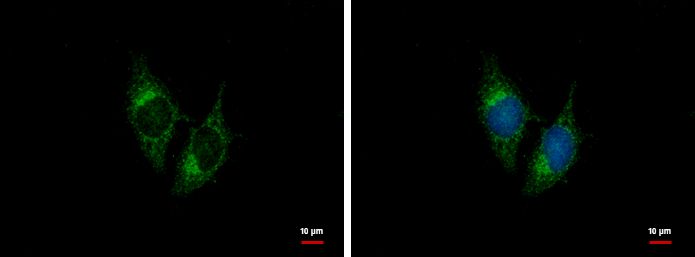 BNP antibody [N1C3]