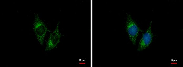 proBNP antibody