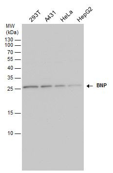 BNP Rabbit Polyclonal Antibody