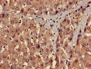 PROC Antibody