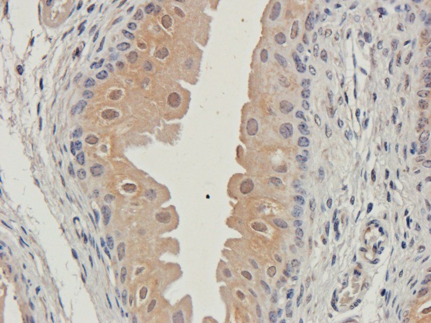 Procollagen type I antibody
