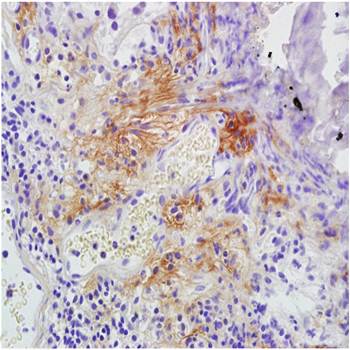 Procollagen type IIA Rabbit Polyclonal Antibody