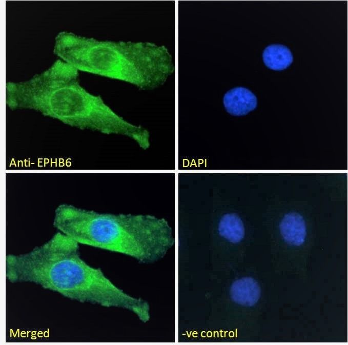 Goat anti-EPHB6 Antibody