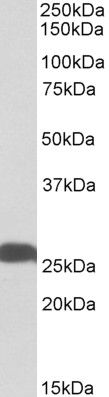 Goat anti-UCHL1 (aa 58-68) Antibody