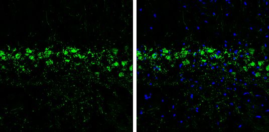 ProDynorphin Rabbit Polyclonal Antibody
