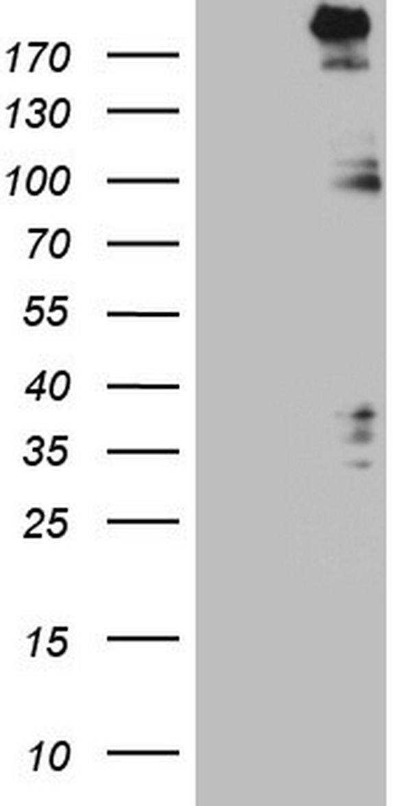 Progesterone Receptor (PGR) antibody