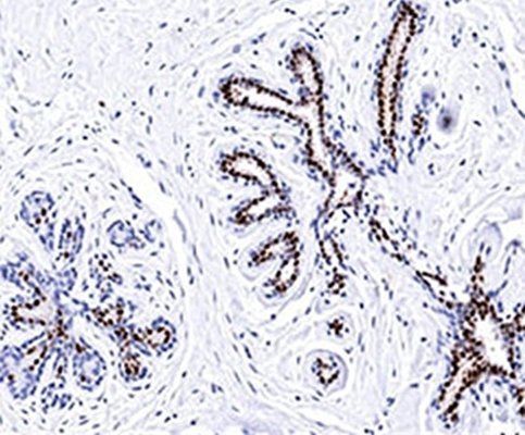 Progesterone Receptor Antibody