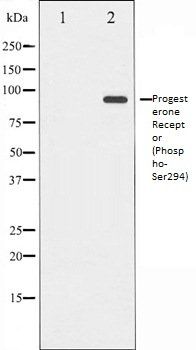 Progesterone Receptor (Phospho-Ser294) antibody