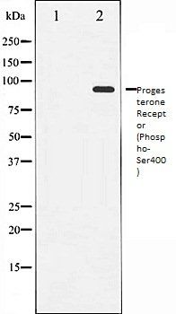 Progesterone Receptor (Phospho-Ser400) antibody
