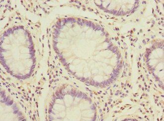 PROK2 Antibody