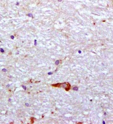 PROK2 Rabbit Polyclonal Antibody