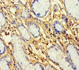 PROKR1 Antibody