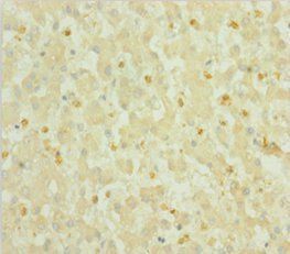 S100A6 Antibody