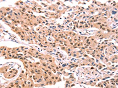 PROS1 Antibody