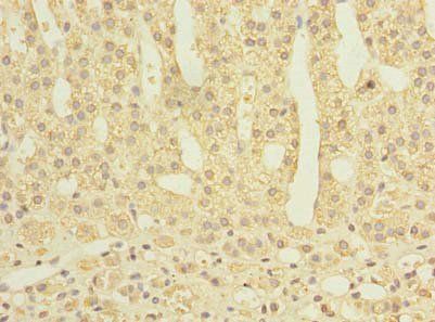 PROSC antibody