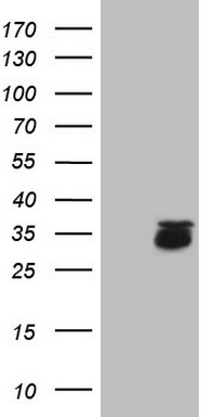 Prostate Specific Antigen (KLK3) antibody