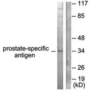 Prostate-specific Antigen antibody