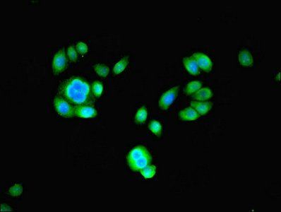 PSMB2 Antibody