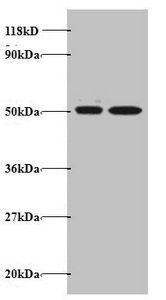 Protein AATF antibody