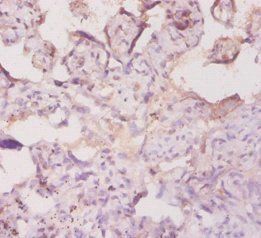 AMBP Antibody