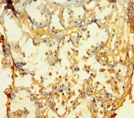 Protein atonal homolog 1 antibody