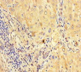 Protein canopy homolog 2 antibody