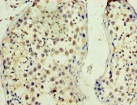 TMX3 Antibody