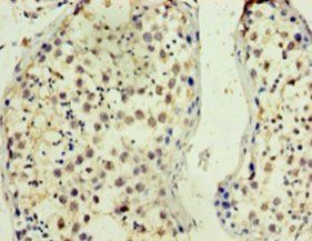 Protein disulfide-isomerase TMX3 antibody