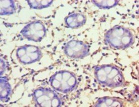 FAM160B1 Antibody