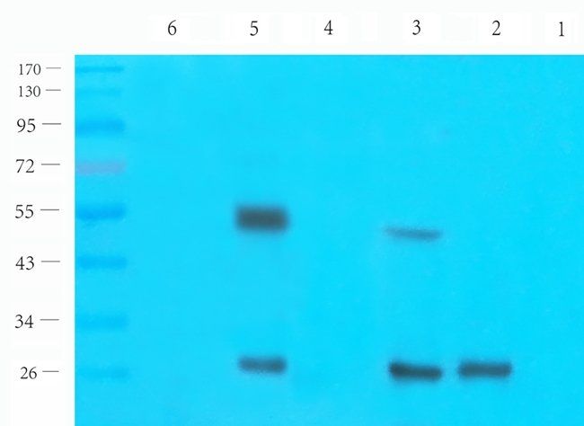 Protein FEV antibody