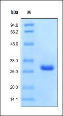 Recombinant Protein G