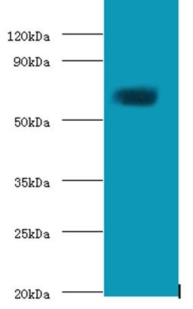 Protein-glutamine gamma-glutamyltransferase 2 antibody