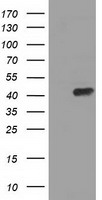 Protein Kinase A regulatory subunit I alpha Antibody