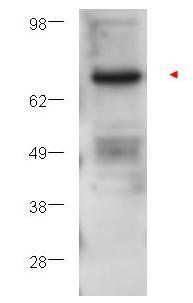 Protein Kinase C Beta antibody
