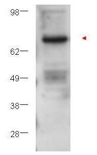 Protein Kinase C Beta antibody