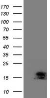 Protein Kinase D2 (PRKD2) antibody