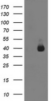 Protein Kinase D2 Antibody