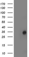 Protein Kinase D2 Antibody