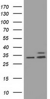 Protein kinase Y linked (PRKY) antibody