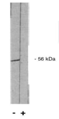Protein Phosphatase 2 A/B antibody