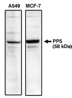 Rabbit anti Human Protein Phosphatase 5 (C Terminal)