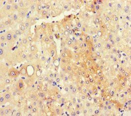 Protein RMD5 homolog A antibody