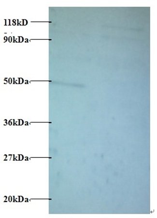 Protein AATF antibody (Biotin)