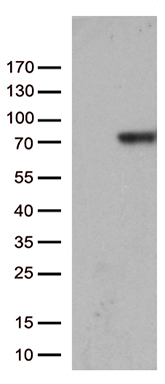 Prothrombin (F2) antibody