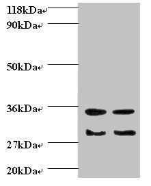 Protransforming growth factor alpha antibody