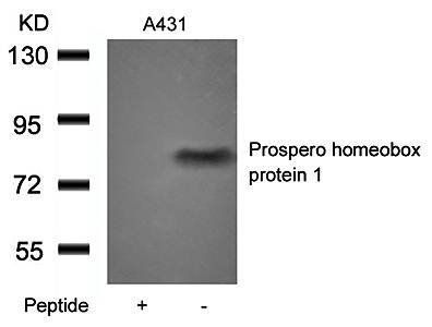 Prospero homeobox protein 1 Antibody
